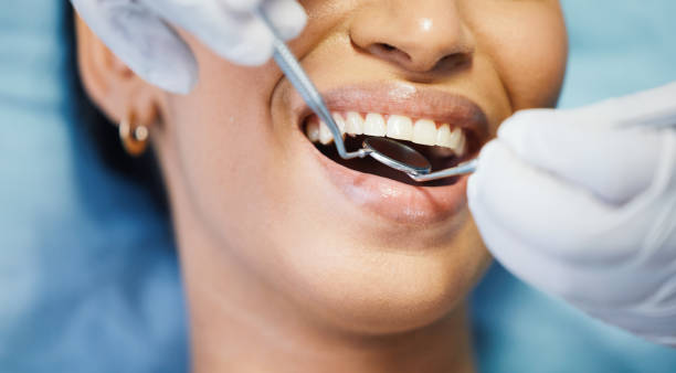 Best Emergency Broken Tooth Repair in Lavonia, GA